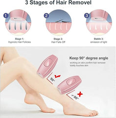 IPL Laser Hair Removal